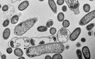 Вижу бактерии. Микроскопические бактерии. Вид микроорганизмов в микроскоп. Бактерии в микроскопе. Электронный микроскоп вид на бактерии.